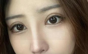 微密圈 - 海豚baby的最新美图：眼镜，这可是潮流的“运气”之源哦！